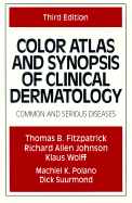 Color atlas and synopsis of clinical dermatology : common and serious diseases.