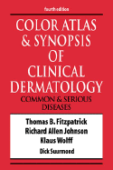 Color Atlas and Synopsis of Clinical Dermatology