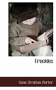 Freckles