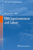 DNA Topoisomerases and Cancer