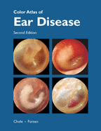 Color Atlas of Ear Disease (Book )