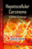 Hepatocellular Carcinoma: A Global Challenge