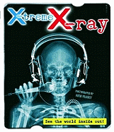 X-treme X-ray