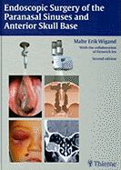 Endoscopic Surgery of the Paranasal Sinuses and Anterior Skull Base