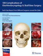 100 Complications of Otorhinolaryngology & Skull Base Surgery: Each Case Report from Different Surgeons Around the Globe
