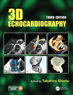 3D Echocardiography - Shiota, Takahiro (Editor)