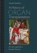 A History of Organ Transplantation: Ancient Legends to Modern Practice