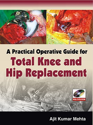 A Practical Operative Guide for Total Knee and Hip Replacement - Mehta Ajit, and Mehta, Ajit Kumar