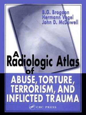 A Radiologic Atlas of Abuse, Torture, Terrorism, and Inflicted Trauma - Brogdon, B G, M.D., and Vogel, Hermann, and McDowell, John D