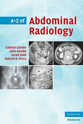 A-Z of Abdominal Radiology - Conder, Gabriel, and Rendle, John, and Kidd, Sarah