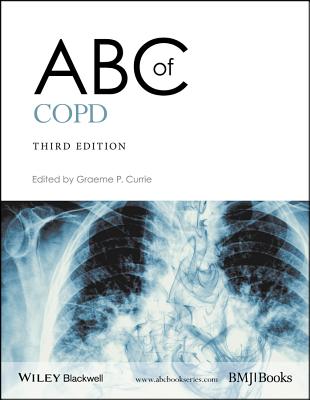 ABC of Copd - Currie, Graeme P (Editor)