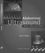 Abdominal Ultrasound: How, Why and When - Smith (Formerly Bates), Jane A, Mphil