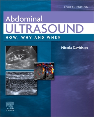 Abdominal Ultrasound: How, Why and When - Davidson, Nicola (Editor)