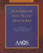 Acetabular and Pelvic Fractures