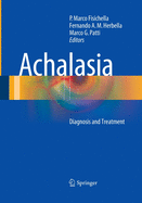 Achalasia: Diagnosis and Treatment