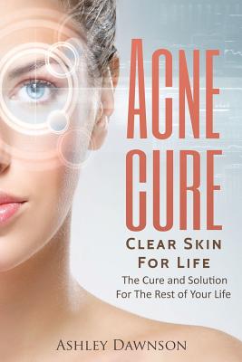 Acne Cure Clear Skin For Life - Dawnson, Ashley