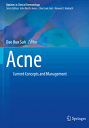 Acne: Current Concepts and Management