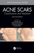 Acne Scars: Classification and Treatment, Second Edition