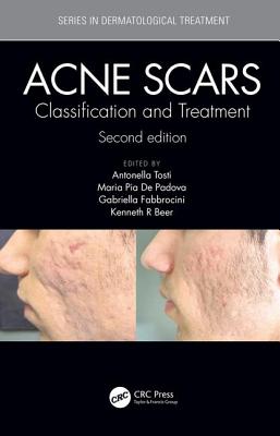 Acne Scars: Classification and Treatment, Second Edition - Tosti, Antonell (Editor), and Pia de Padova, Maria (Editor), and Fabbrocini, Gabriella (Editor)