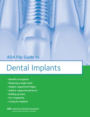 ADA Flip Guide to Dental Implants - American Dental Association