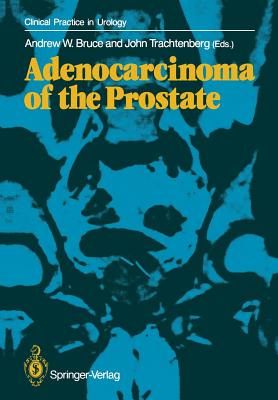 Adenocarcinoma of the Prostate - Bruce, Andrew W (Editor), and Trachtenberg, John (Editor)