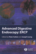Advanced Digestive Endoscopy: ERCP