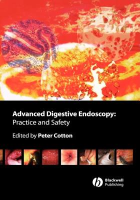 Advanced Digestive Endoscopy: Practice & Safety - Cotton, Peter B (Editor)