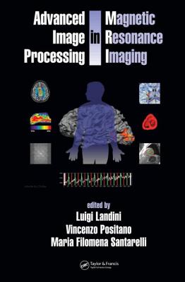 Advanced Image Processing in Magnetic Resonance Imaging - Landini, Luigi (Editor), and Positano, Vincenzo (Editor), and Santarelli, Maria (Editor)