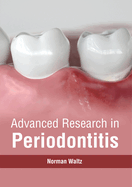Advanced Research in Periodontitis