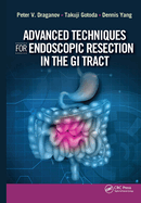 Advanced Techniques for Endoscopic Resection in the GI Tract