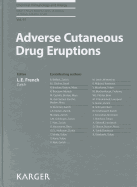 Adverse Cutaneous Drug Eruptions