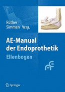 Ae-Manual Der Endoprothetik: Ellenbogen