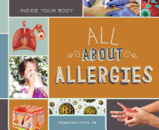 All about Allergies