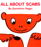 All about Scabs