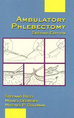 Ambulatory Phlebectomy - Goldman, Mitchel P, MD (Editor), and Georgiev, Mihael (Editor), and Ricci, Stefano (Editor)