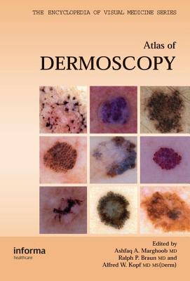 An Atlas of Dermoscopy - Marghoob, Ashfaq A, MD (Editor), and Braun, Ralph (Editor), and Kopf, Alfred W (Editor)