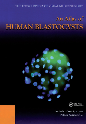 An Atlas of Human Blastocysts - Veeck, Lucinda L, and Zaninovic, Nikica