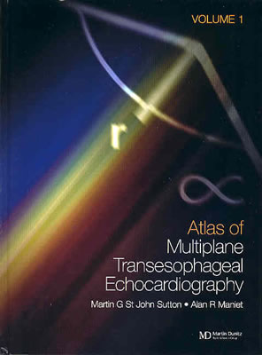 An Atlas of Multiplane Transesophageal Echocardiography - St John Sutton, Martin G, and Maniet, Alan R