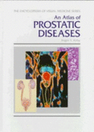 An Atlas of Prostatic Diseases - Kirby, Roger S