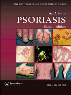 An Atlas of Psoriasis