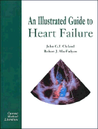 An Illustrated Guide to Heart Failure