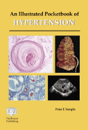 An Illustrated Pocketbook of Hypertension