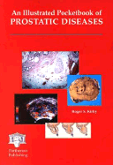 An Illustrated Pocketbook of Prostatic Diseases