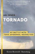 An Inner Tornado: My battle with Toxic Epidermal Necrolysis