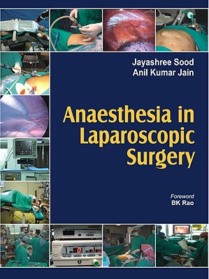 Anaesthesia in Laparoscopic Surgery - Sood, Jayashree, and Jain, Anil Kumar