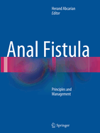 Anal Fistula: Principles and Management