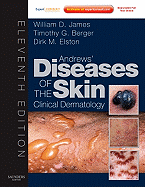 Andrews' Diseases of the Skin: Clinical Dermatology - Expert Consult - Online and Print