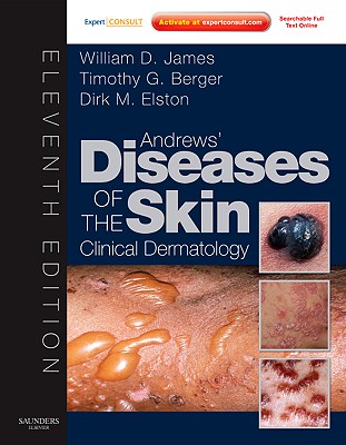 Andrews' Diseases of the Skin: Clinical Dermatology - Expert Consult - Online and Print - James, William D, Col., MD, and Elston, Dirk M, MD, and Berger, Timothy, MD