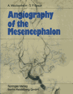 Angiography of the Mesencephalon: Normal and Pathological Findings