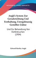 Angle's System Zur Geraderichtung Und Festhaltung, Unregalmassig Gestellter Zahne: Und Zur Behandlung Von Kieferbruchen (1904)